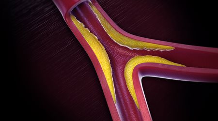 عروق کرونر قلب 🔗