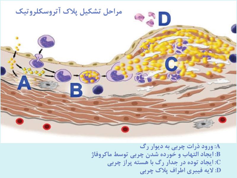 درد قلبی