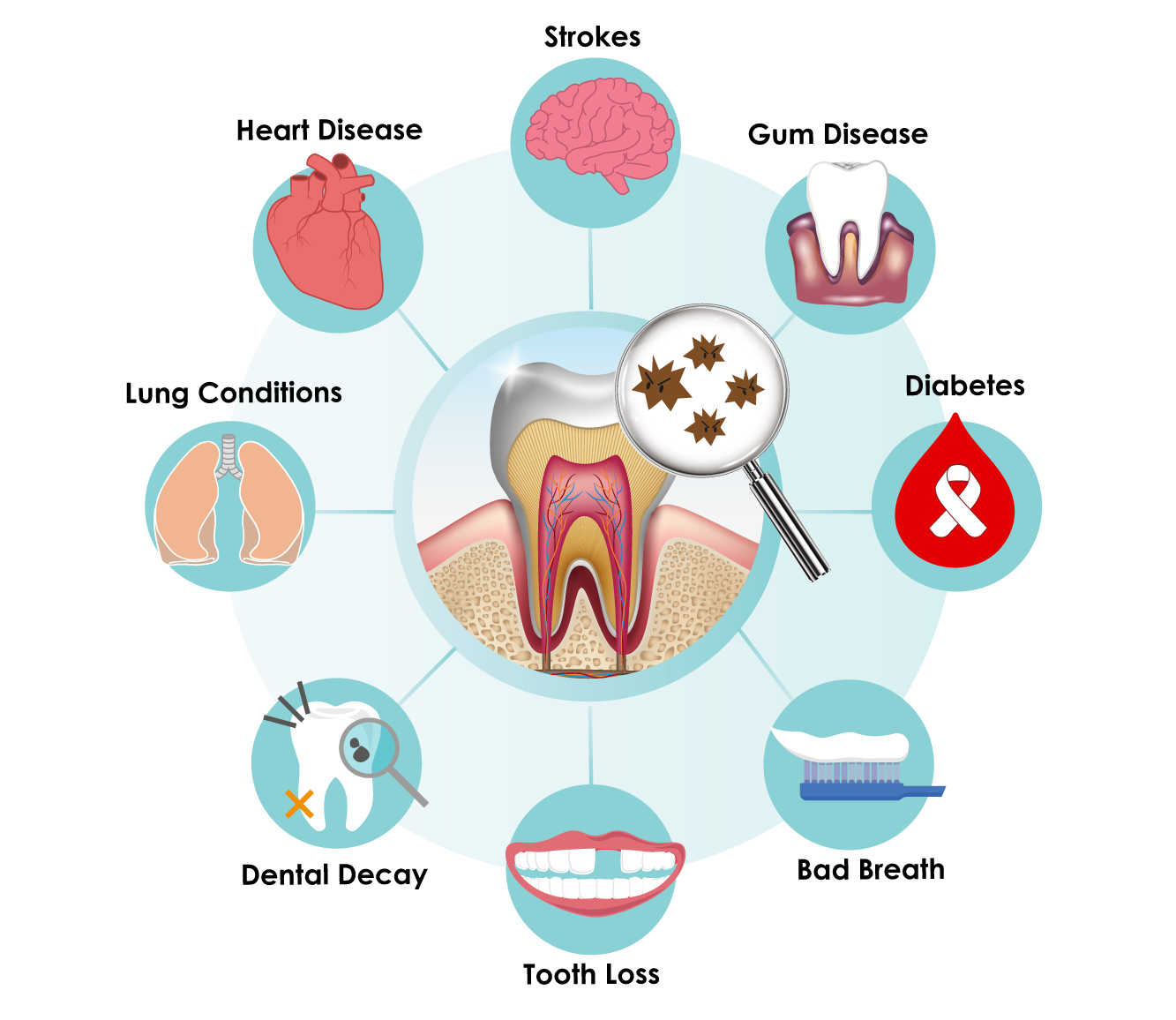 پیشگیری از اندوکاردیت عفونی