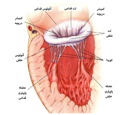 نارسايي ميترال