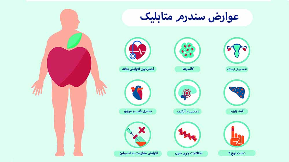 سندرم متابلیک