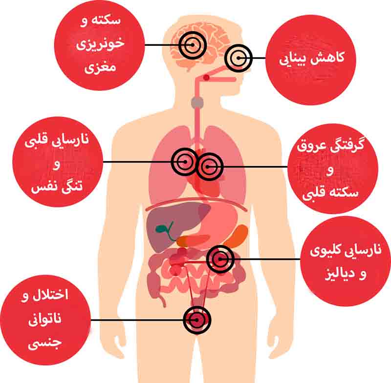 عوارض فشارخون بالا