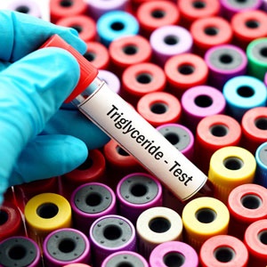 همه چیز در مورد تری گلیسرید خون